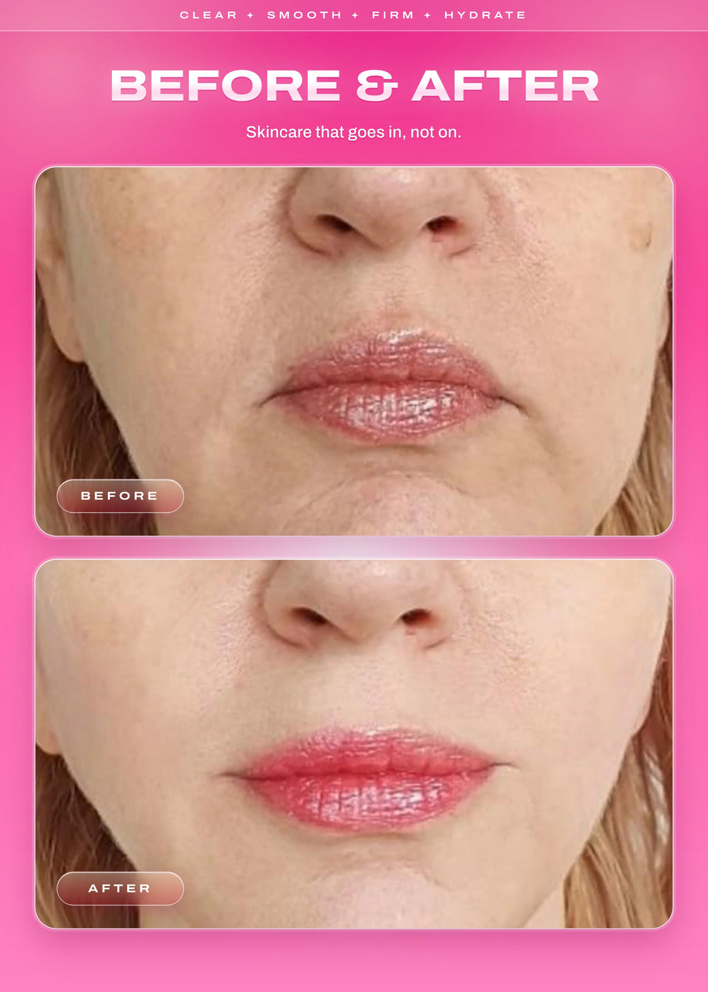 It Girl Skin | Strawberry Beauty Gummies
